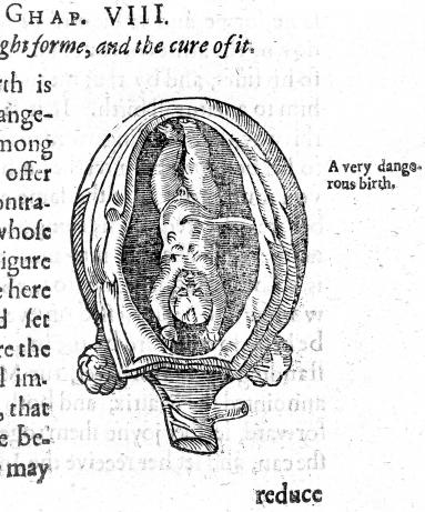 Rueff birth figure Birth figure