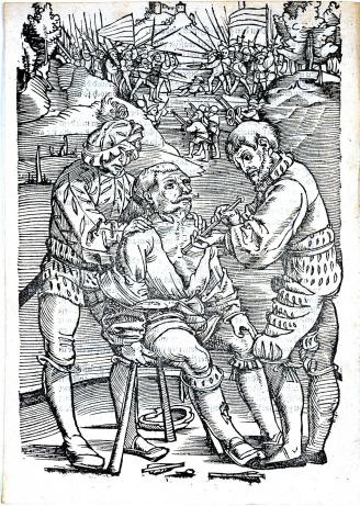 This image from military surgeon Hans von Gersdorff's popular surgical manual shows a surgeon and his assistant working to remove an arrow from an injured man's body. The battle rages on in the background. 