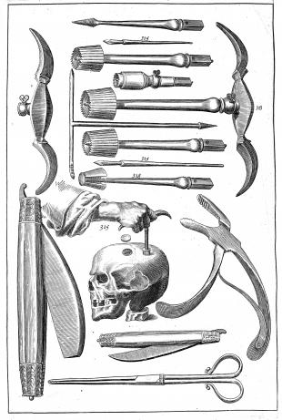 This image, from the 1639 edition of The surgeons mate, shows tools used to perform trepanation, an operation in which the surgeon drills a hole into the skull.