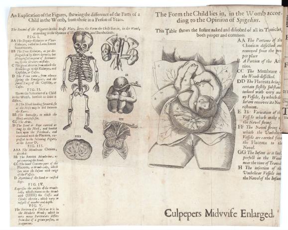 Illustrations of infant skeleton and foetus in utero 